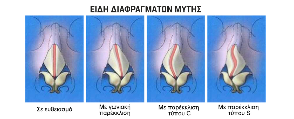 διαφραγμα μυτης